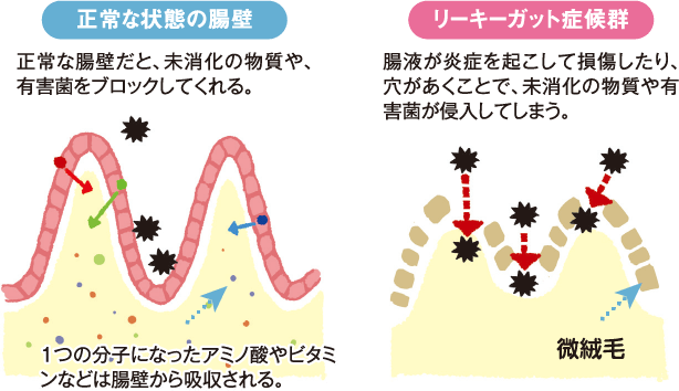 Hấp thụ dinh dưỡng