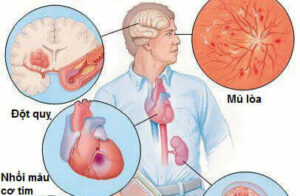 Postbiotics bien chung