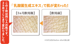 Lợi khuẩn đường ruột -10