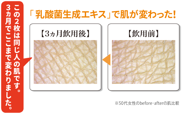 Lợi khuẩn đường ruột -10